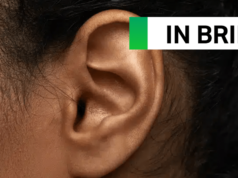 Google is engaged on AI that may hear indicators of illness