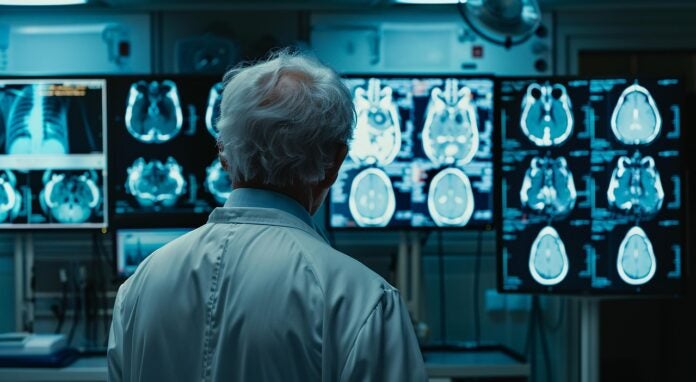 A doctor in a white lab coat examines X-ray images on multiple monitors in a dimly lit medical facility, focusing on the detailed scans.
