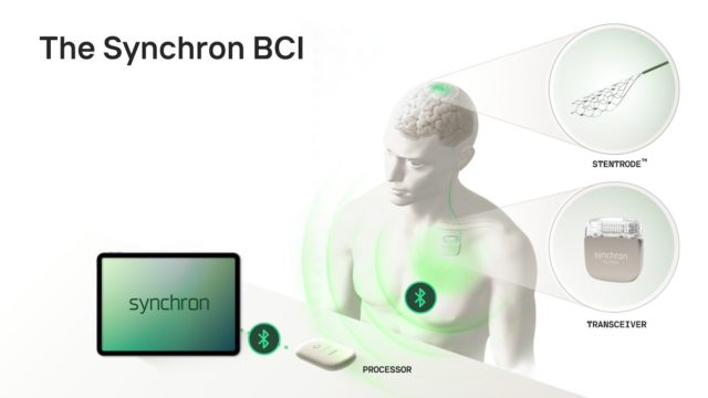 1747333425_Brain-Controlled-iPhones-Apples-Helping-Pioneer-This-Next.jpg An overview of Synchron